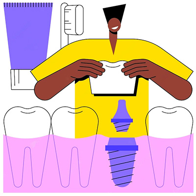 Braces